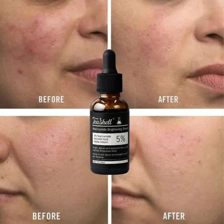 Teashell 5% Niacinamide Brightening Serum