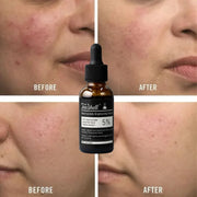 Teashell 5% Niacinamide Brightening Serum