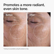 Glycolic Acid 7% Exfoliating Toner (Allow to Open)